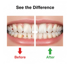 Smart Water Flosser Teeth Cleaner For Cleaning Teeth